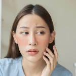 aInsights Into Lupus Treatment Singapore Patients Should Understand